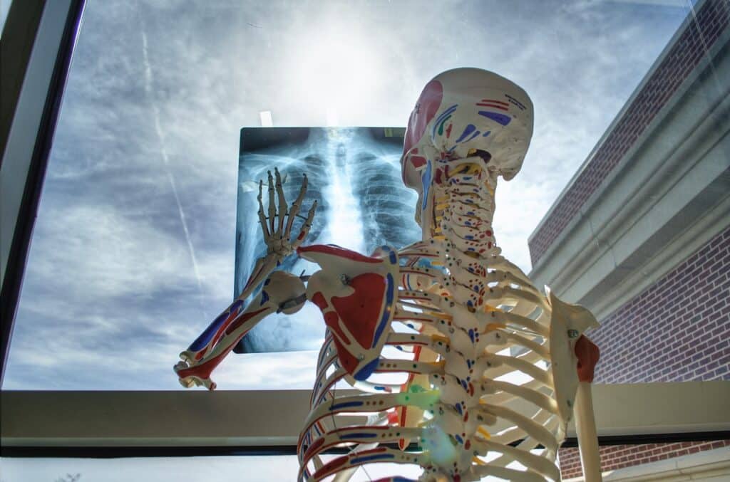 skeleton 2561573 1280